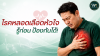 โรคหลอดเลือดหัวใจ รู้ก่อน ป้องกันได้! โรคหลอดเลือดหัวใจ รู้ก่อน ป้องกันได้!