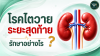 โรคไตวายระยะสุดท้าย รักษาอย่างไร? รู้จักอาการและทางเลือกในการรักษา โรคไตวายระยะสุดท้าย รักษาอย่างไร? รู้จักอาการและทางเลือกในการรักษา