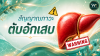 ตับอักเสบ สัญญาณที่ไม่ควรมองข้าม ตับอักเสบ สัญญาณที่ไม่ควรมองข้าม