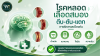โรคหลอดเลือดสมอง ปัจจัยเสี่ยงที่หลีกเลี่ยงได้ โรคหลอดเลือดสมอง ปัจจัยเสี่ยงที่หลีกเลี่ยงได้