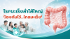 รู้ทันมะเร็งลำไส้ใหญ่ ก่อนโรคร้ายมาเยือน รู้ทันมะเร็งลำไส้ใหญ่ ก่อนโรคร้ายมาเยือน