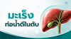 มะเร็งท่อน้ำดีในตับ ภัยเงียบที่ไม่ควรมองข้าม