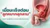 มะเร็งต่อมลูกหมาก ภัยเงียบในผู้ชายที่ควรรู้ พร้อมแนวทางสังเกตอาการและตรวจคัดกรอง