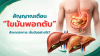 สัญญาณเตือน “ไขมันพอกตับ” รู้ทันอาการเริ่มต้นก่อนตับเสียหาย สัญญาณเตือน “ไขมันพอกตับ” รู้ทันอาการเริ่มต้นก่อนตับเสียหาย