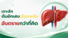 เจาะลึก “ตับอักเสบเฉียบพลัน” ภัยเงียบอันตรายกว่าที่คิด เจาะลึก “ตับอักเสบเฉียบพลัน” ภัยเงียบอันตรายกว่าที่คิด