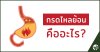 กรดไหลย้อน คืออะไร? กรดไหลย้อน คืออะไร?
