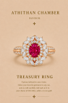 TREASURY RING