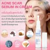 ACNE SCAR SERUM IN CREAM