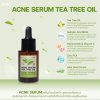 ACNE SERUM TEA TREE OIL