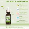 TEA TREE OIL ACNE SERUM