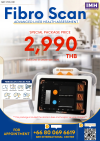 FibroScan – Advanced Liver Health Assessment
