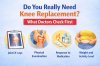 Do You Really Need Knee Replacement? What Doctors Check First
