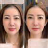 สักคิ้วลายเส้น Hairstoke Techique Physiognomy women