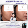 รีวิว PicoSure Laser