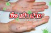 รู้ไว้ พร้อมรับมือโรคมือ เท้า ปาก