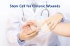 แนวทางการรักษาแผลเรื้อรังด้วยสเต็มเซลล์ แนวทางการรักษาแผลเรื้อรังด้วยสเต็มเซลล์