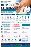 Deep Cut Stitches Price Samui. The 2026 Guide to Fast, Professional Sutures Deep Cut Stitches Price Samui. The 2026 Guide to Fast, Professional Sutures