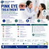 Pink Eye Treatment Koh Samui. The 2026 Guide to Curing Eye Infections Fast