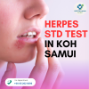 Herpes STD Test in Koh Samui: The Truth About Swabs vs. Blood Tests