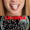 &quot;Candida – Causes, Symptoms, and Treatment&quot;