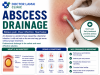 Abscess Drainage Koh Samui. The 2026 Guide to Safe, Immediate Relief
