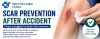 Scar Prevention After Accident: The 2026 Guide to Healing Without a Trace Scar Prevention After Accident: The 2026 Guide to Healing Without a Trace