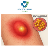 staph infection on skin staph infection on skin