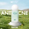 Anti Acne Serum