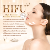 HIFU คืออะไร HIFU คืออะไร