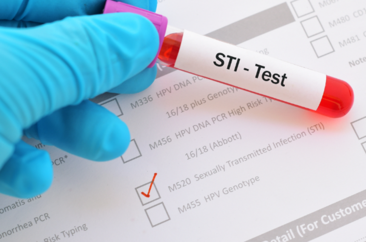 The Best At Home STD Test Kits (2026): Accuracy, Privacy, and Speed Ranked