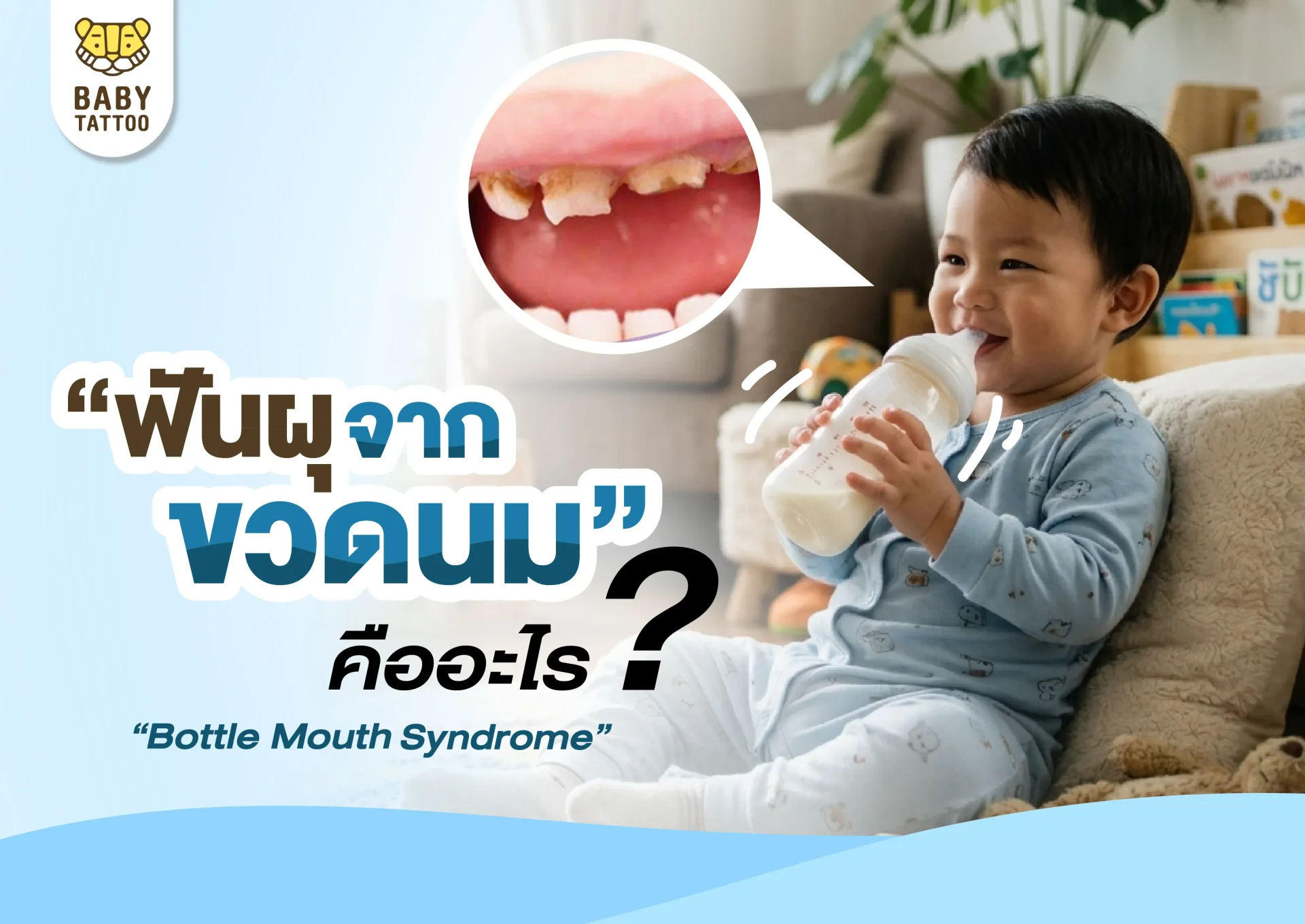 ฟันผุจากขวดนม คืออะไร ฟันผุจากขวดนม คืออะไร