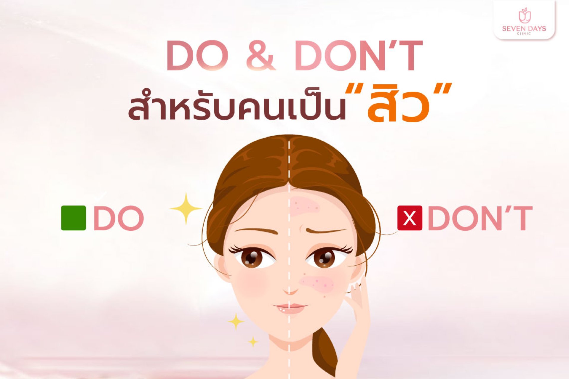 รักษาสิว รักษาสิว