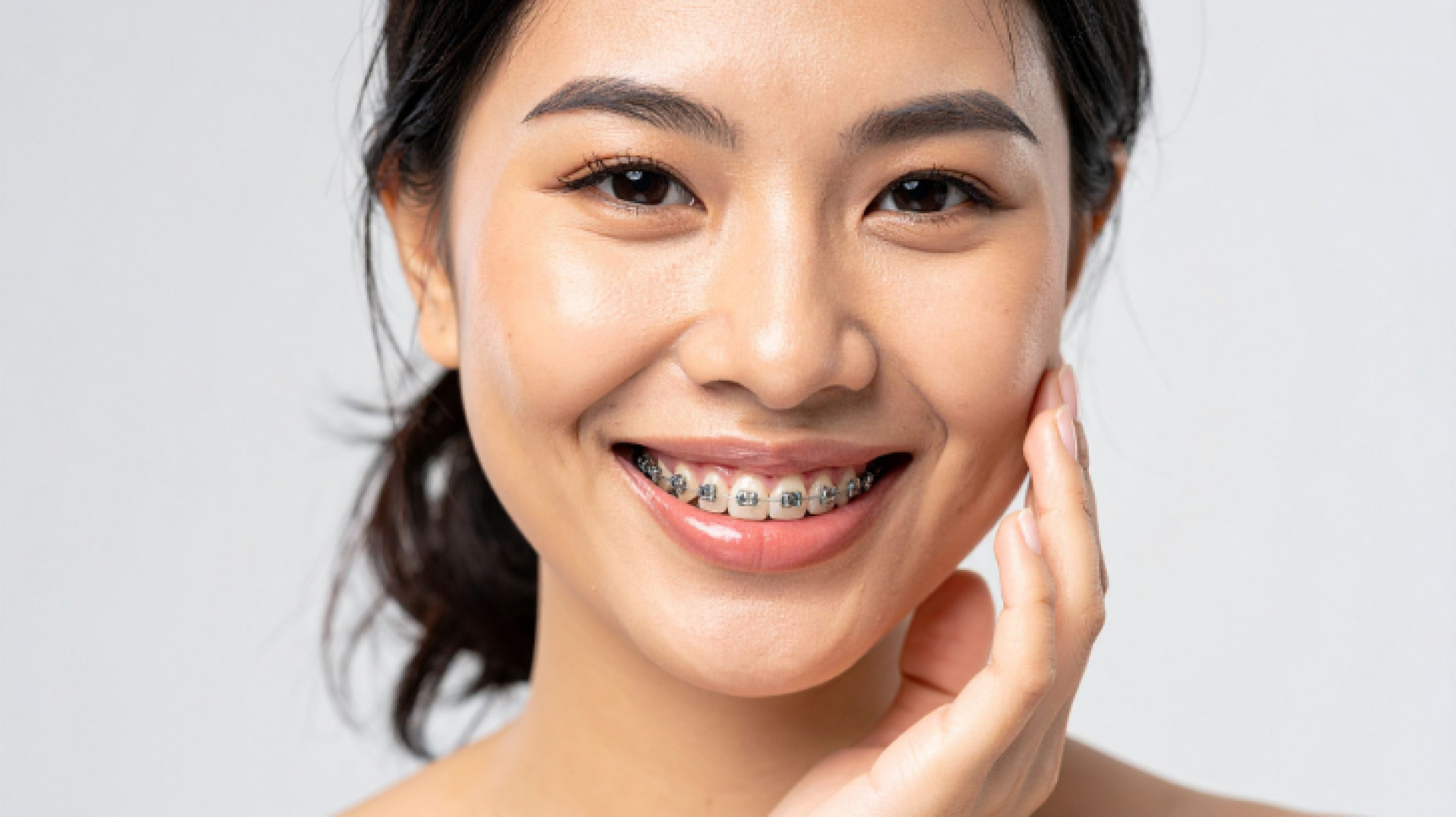 orthodontic step orthodontic step