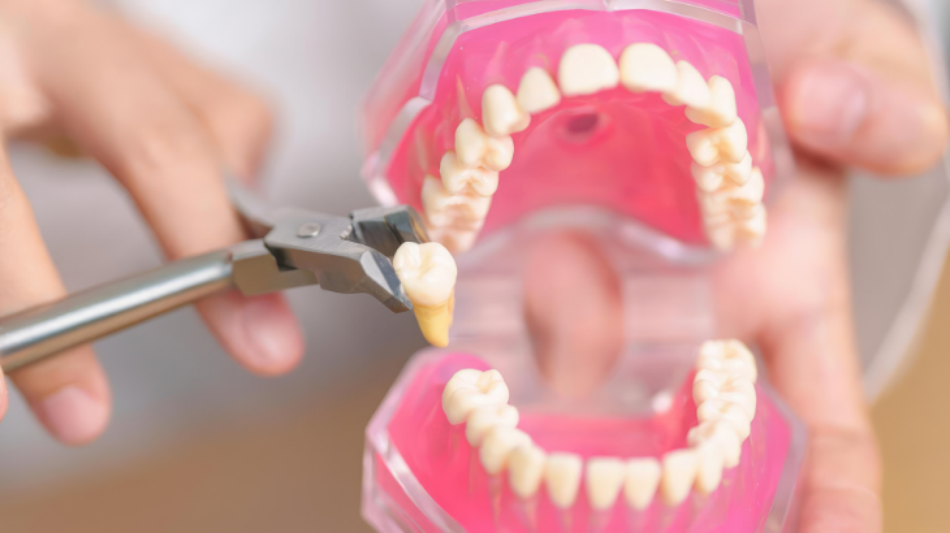 wisdom tooth surgery wisdom tooth surgery