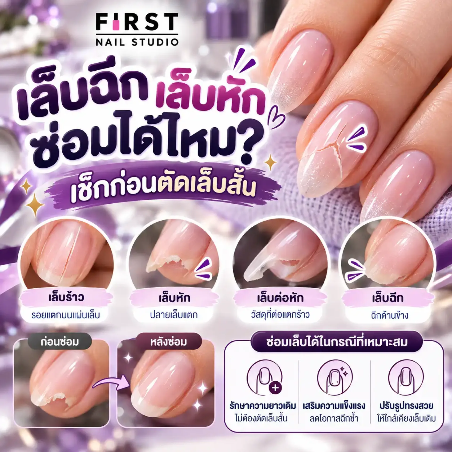 เล็บฉีก เล็บหัก ซ่อมได้ไหม วิธีซ่อมเล็บหักและเล็บร้าว เล็บฉีก เล็บหัก ซ่อมได้ไหม วิธีซ่อมเล็บหักและเล็บร้าว
