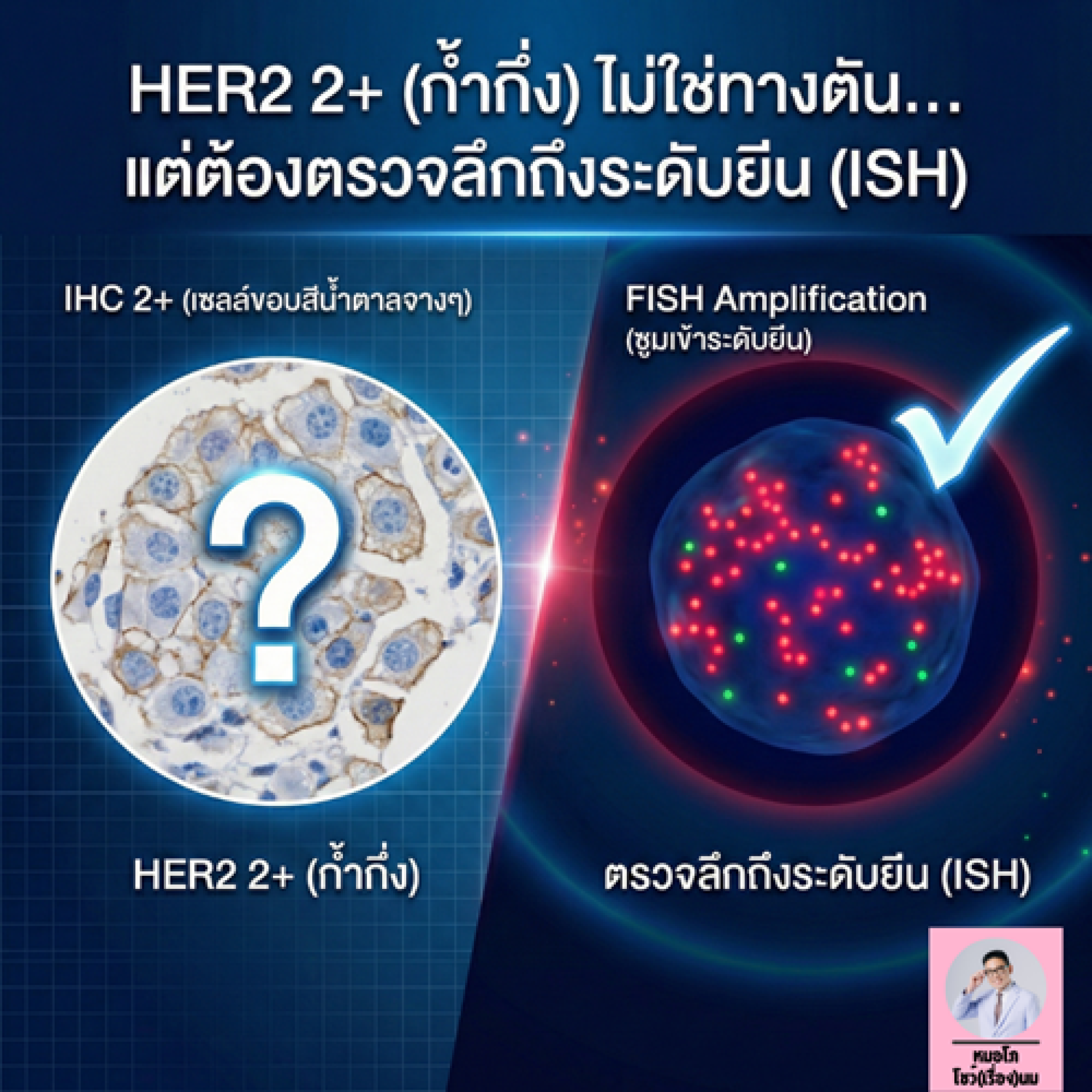 HER2 2+ (Equivocal) คืออะไร? ต้องตรวจ ISH/FISH ต่อไหม
