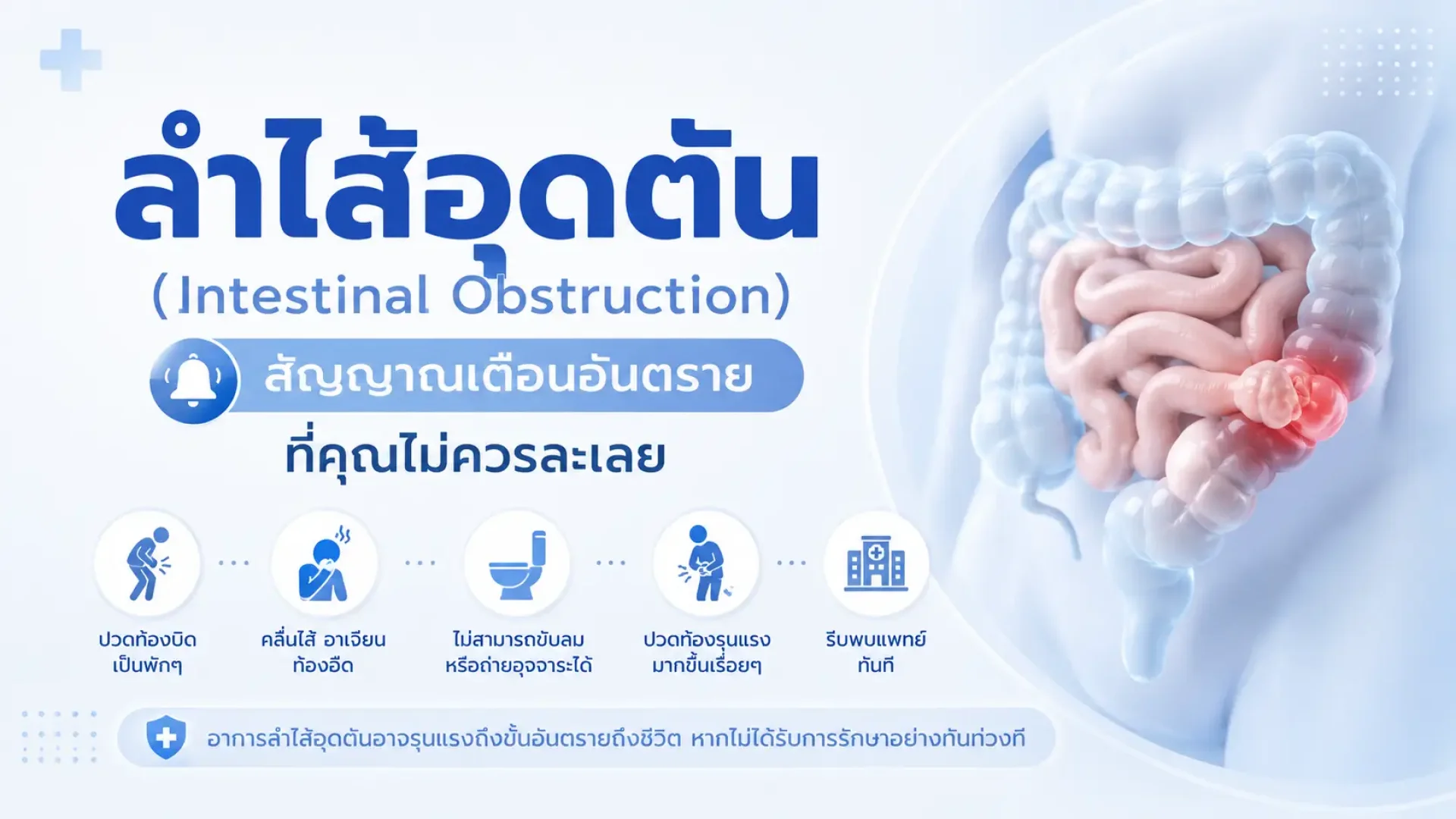 ลำใส้อุดตัน, เซเปี้ยนซ์, sapiens ลำใส้อุดตัน, เซเปี้ยนซ์, sapiens