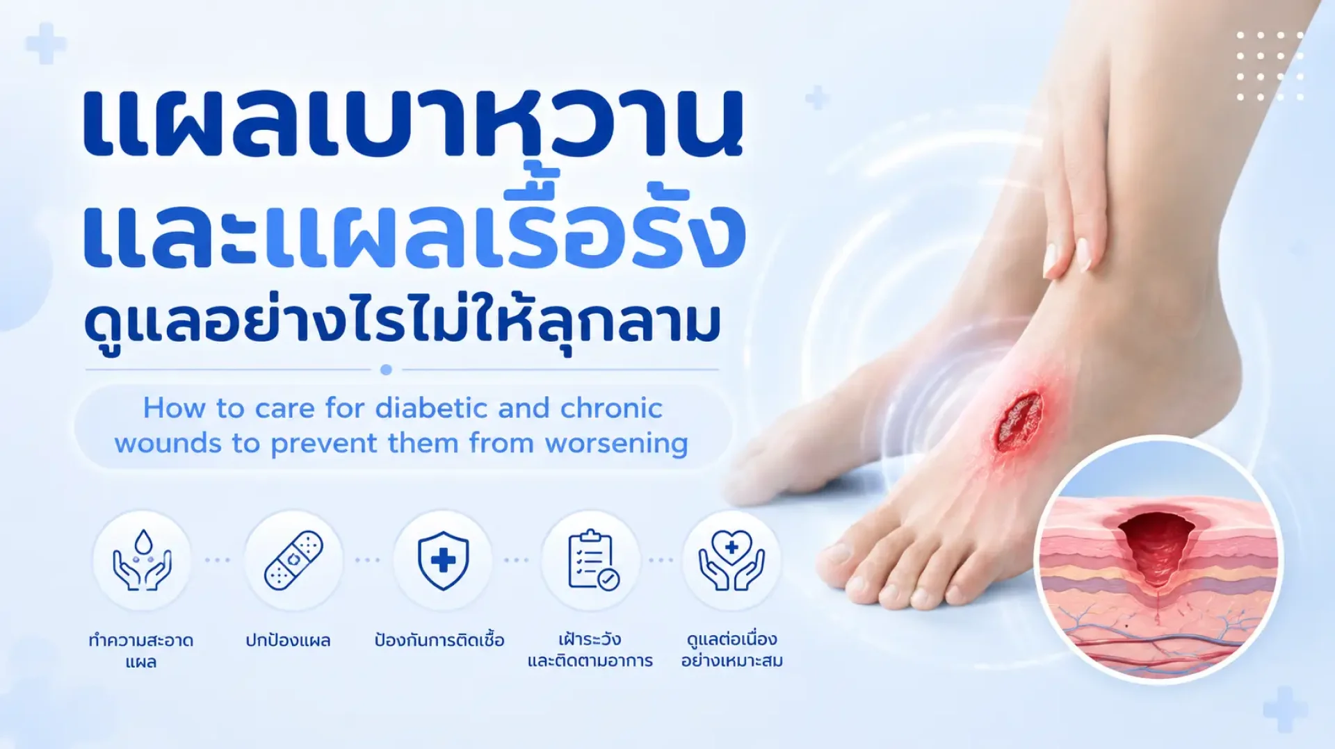 เบาหวาน, แผย, เรื้อรัง, เซเปี้ยนซ์, sapiens, อายุรกรรม เบาหวาน, แผย, เรื้อรัง, เซเปี้ยนซ์, sapiens, อายุรกรรม