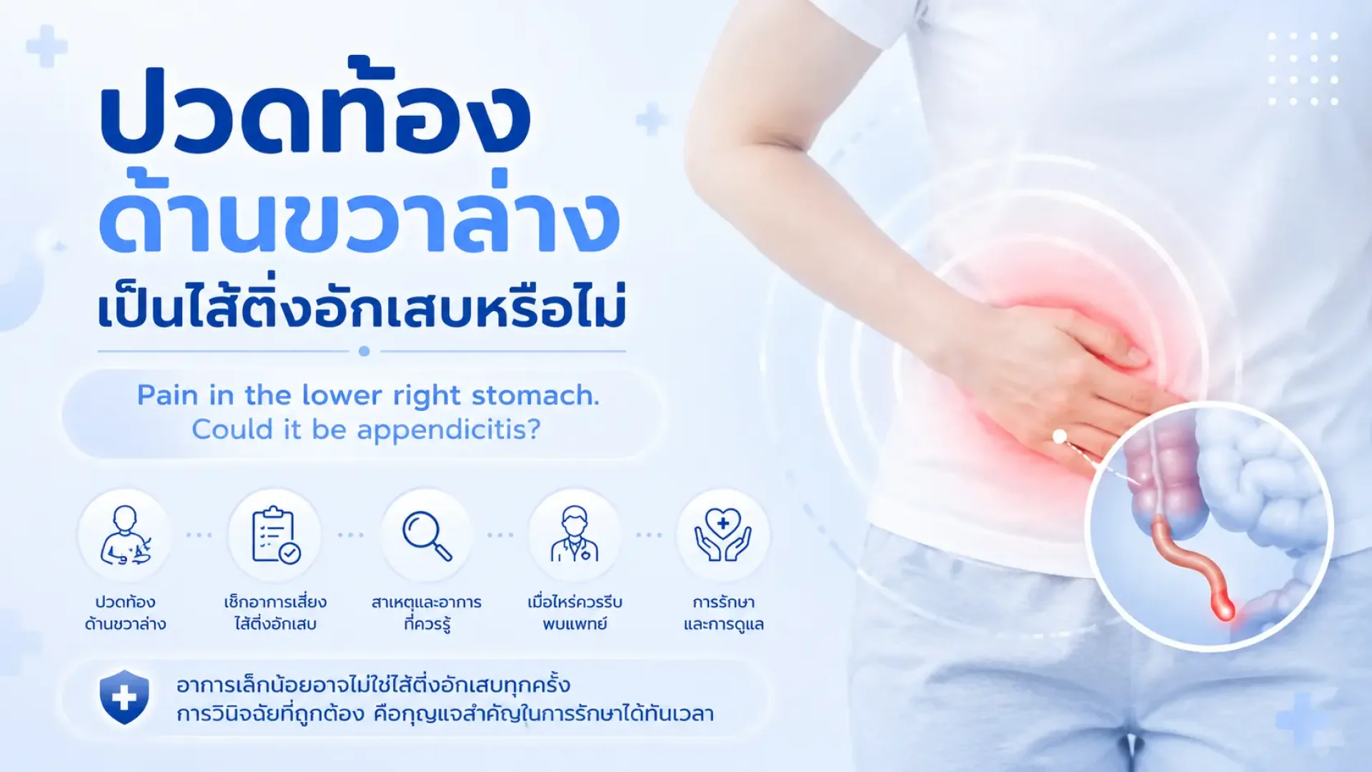 ใส้ติ่ง, ปวดท้อง เซเปี้ยนซ์, sapiens, อายุรกรรม ใส้ติ่ง, ปวดท้อง เซเปี้ยนซ์, sapiens, อายุรกรรม