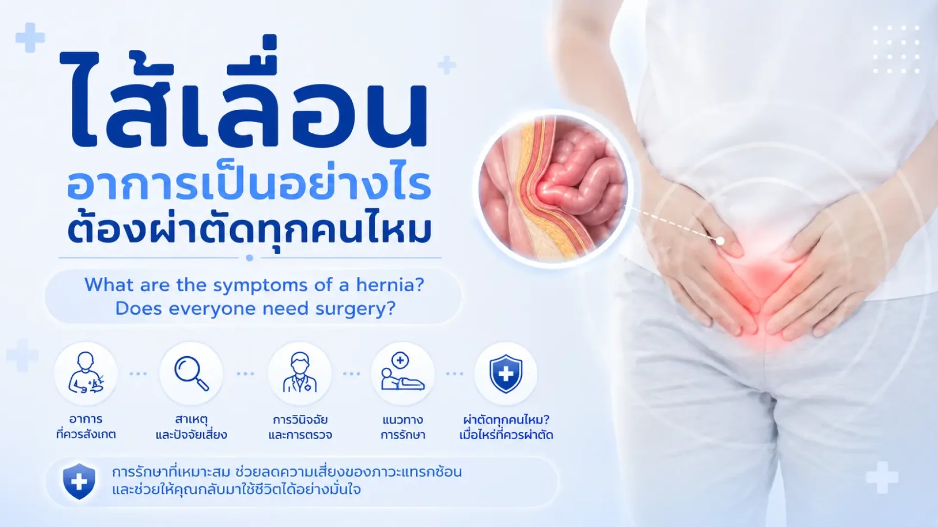ใส้เลื่อน, ปวดท้อง เซเปี้ยนซ์, sapiens, อายุรกรรม ใส้เลื่อน, ปวดท้อง เซเปี้ยนซ์, sapiens, อายุรกรรม