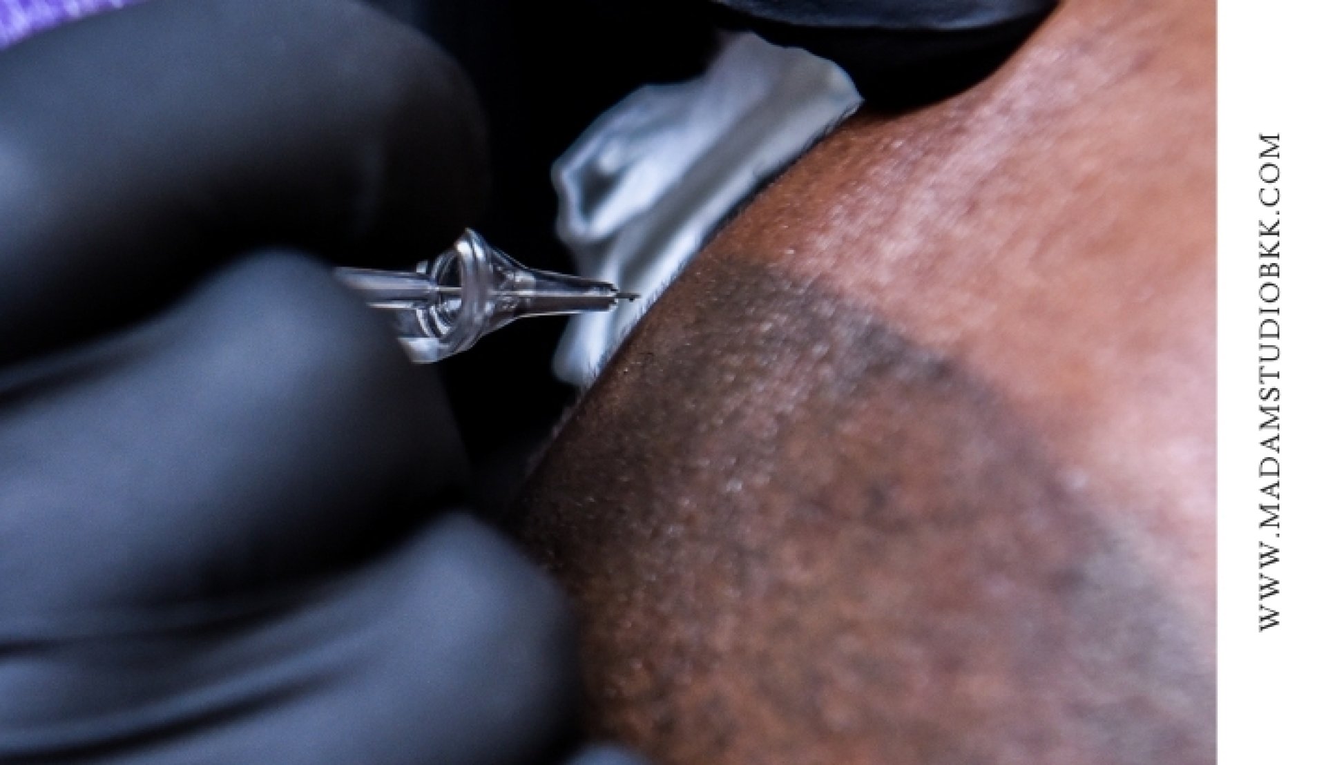 Scalp Micropigmentation bangkok Scalp Micropigmentation bangkok