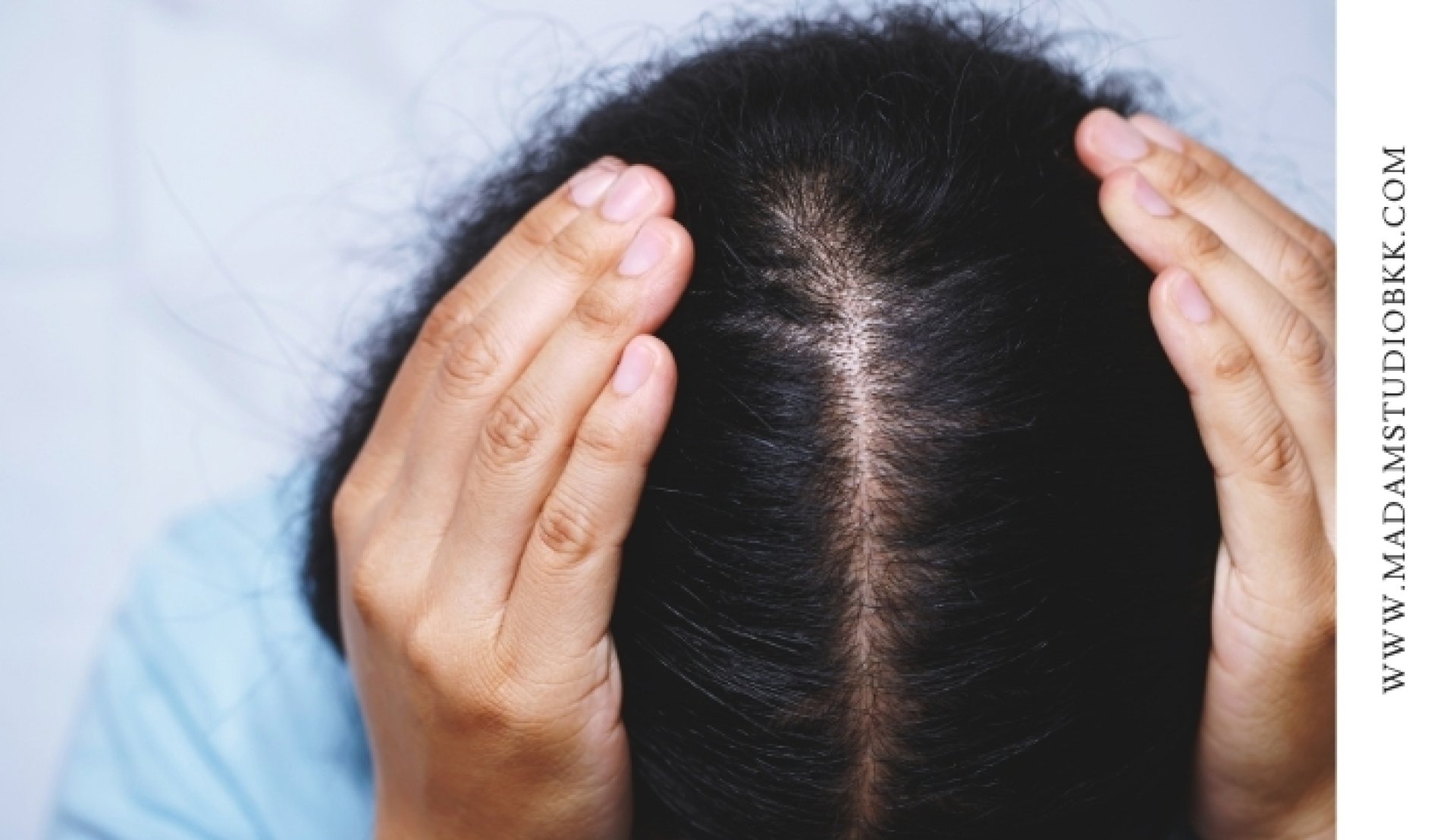 Scalp Micropigmentation Bangkok guide for choosing an SMP artist for hair thinning and baldness concerns สักตอผมที่ไหนดี Scalp Micropigmentation Bangkok guide for choosing an SMP artist for hair thinning and baldness concerns สักตอผมที่ไหนดี