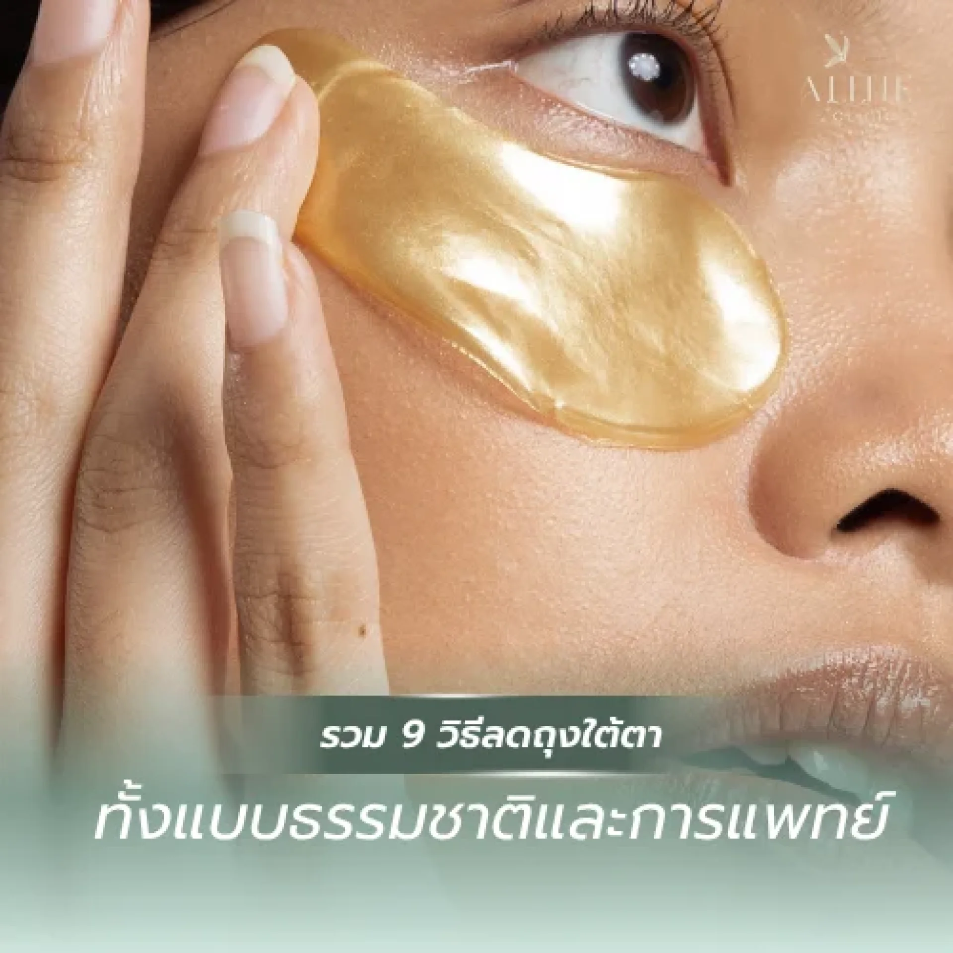 วิธีลดถุงใต้ตา วิธีลดถุงใต้ตา