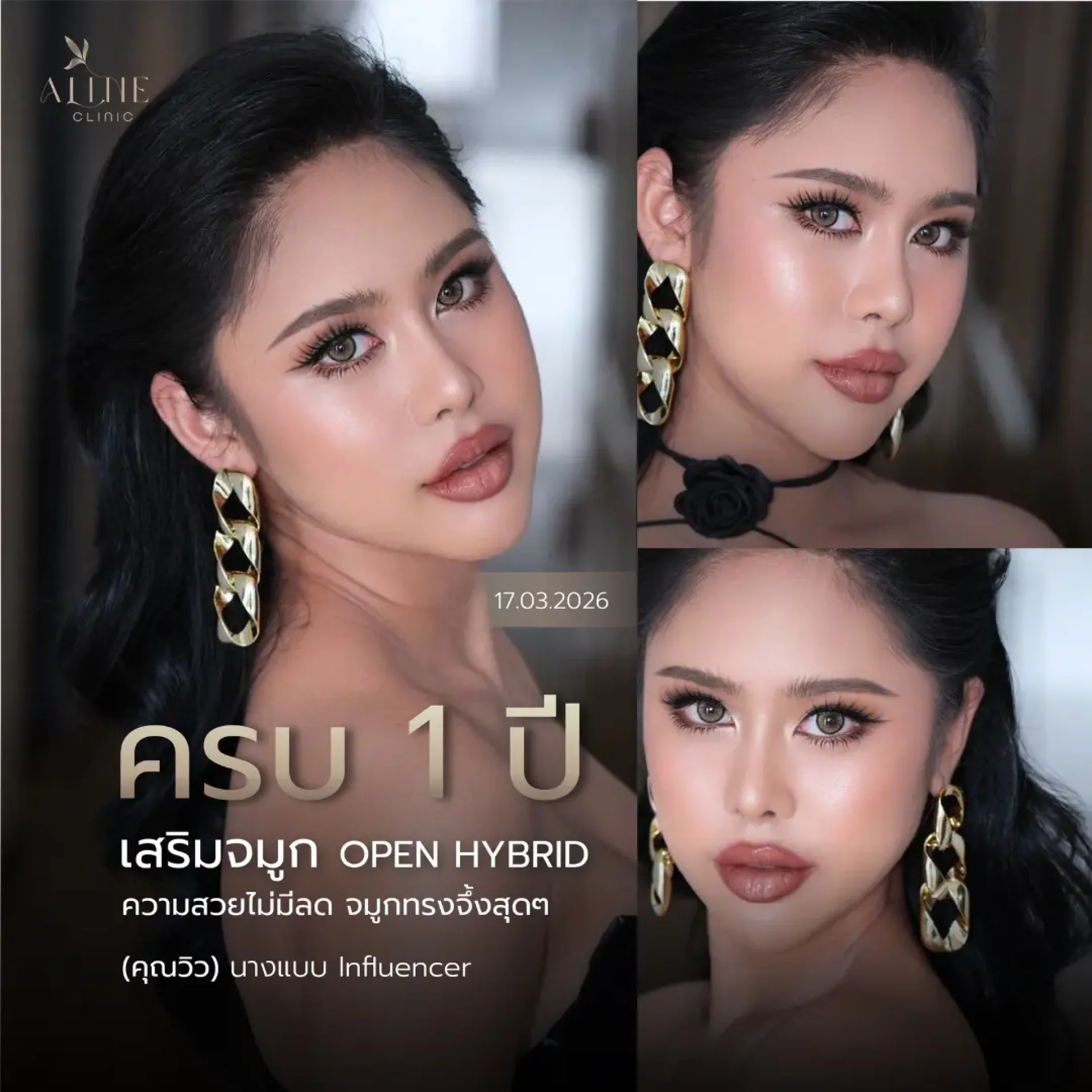 รีวิวแก้จมูก aline clinic โคราช รีวิวแก้จมูก aline clinic โคราช