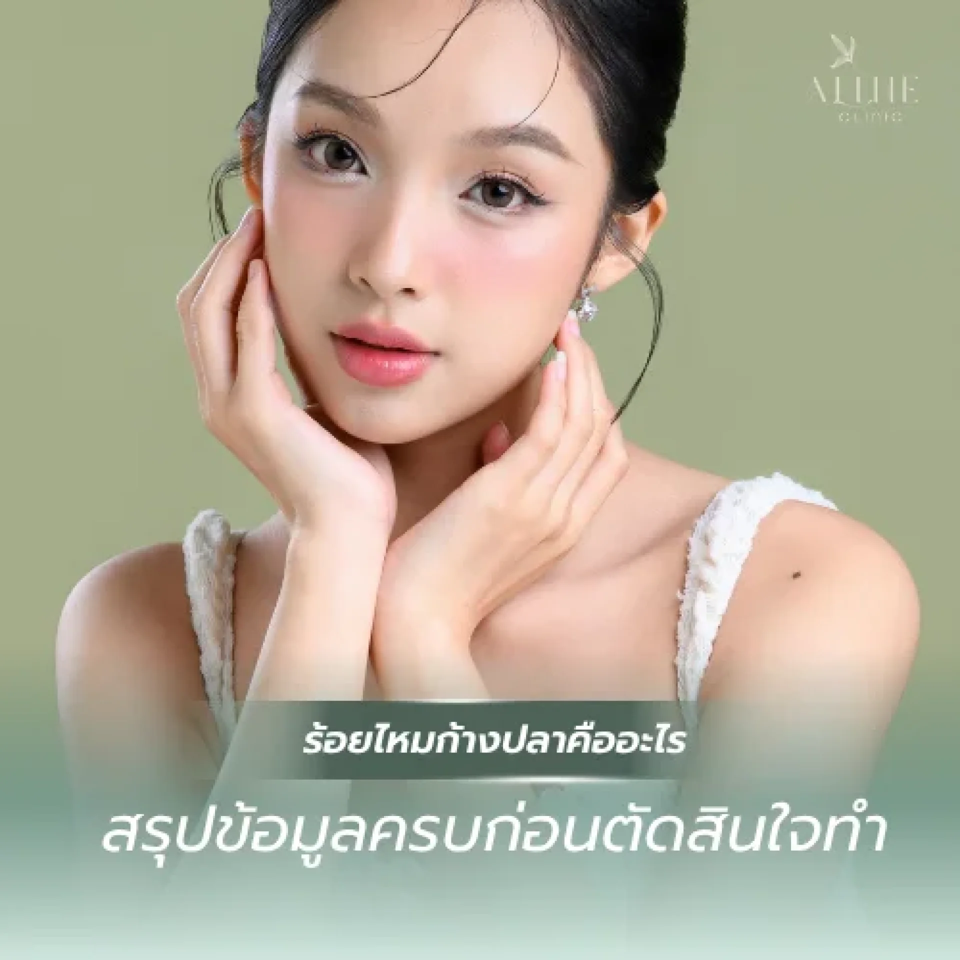 ร้อยไหมก้างปลาคืออะไร ร้อยไหมก้างปลาคืออะไร