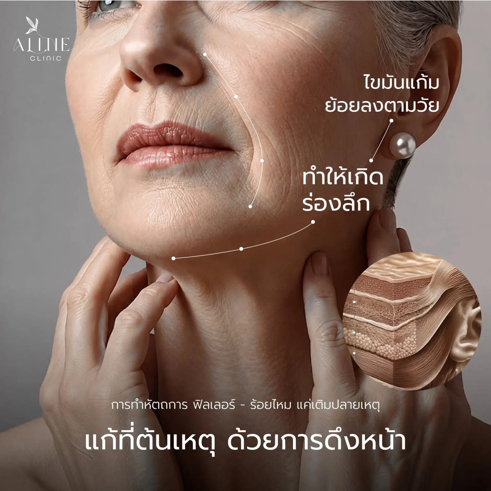 ดึงหน้าพักฟื้นกี่วัน ดึงหน้ากี่วันยุบ ดึงหน้าพักฟื้นกี่วัน ดึงหน้ากี่วันยุบ
