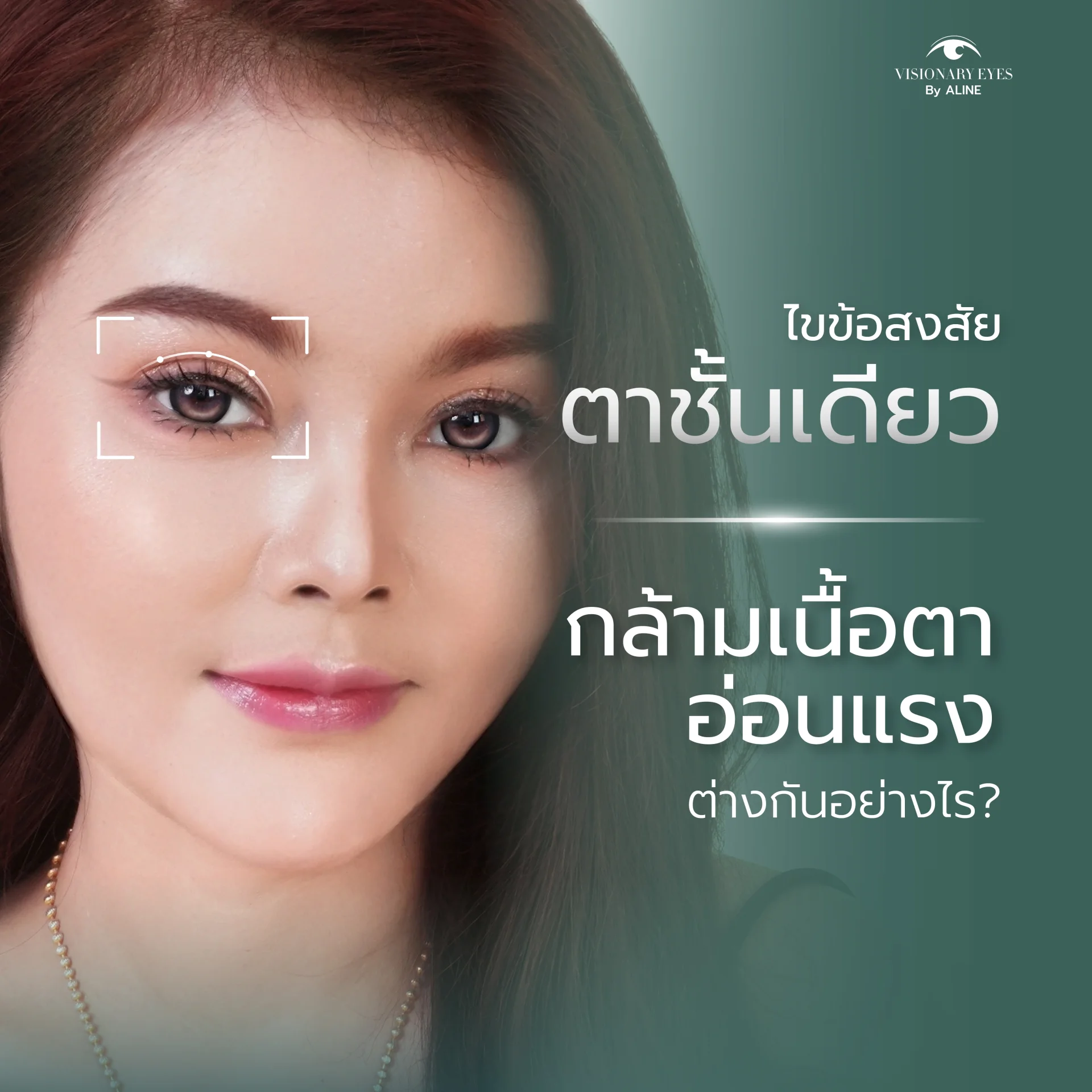 ไขข้อสงสัย “ตาชั้นเดียว” กับ “กล้ามเนื้อตาอ่อนแรง” ต่างกันอย่างไร? เลือกเทคนิคแก้ชั้นตาแบบไหนให้สวยเป็นธรรมชาติ ไขข้อสงสัย “ตาชั้นเดียว” กับ “กล้ามเนื้อตาอ่อนแรง” ต่างกันอย่างไร? เลือกเทคนิคแก้ชั้นตาแบบไหนให้สวยเป็นธรรมชาติ