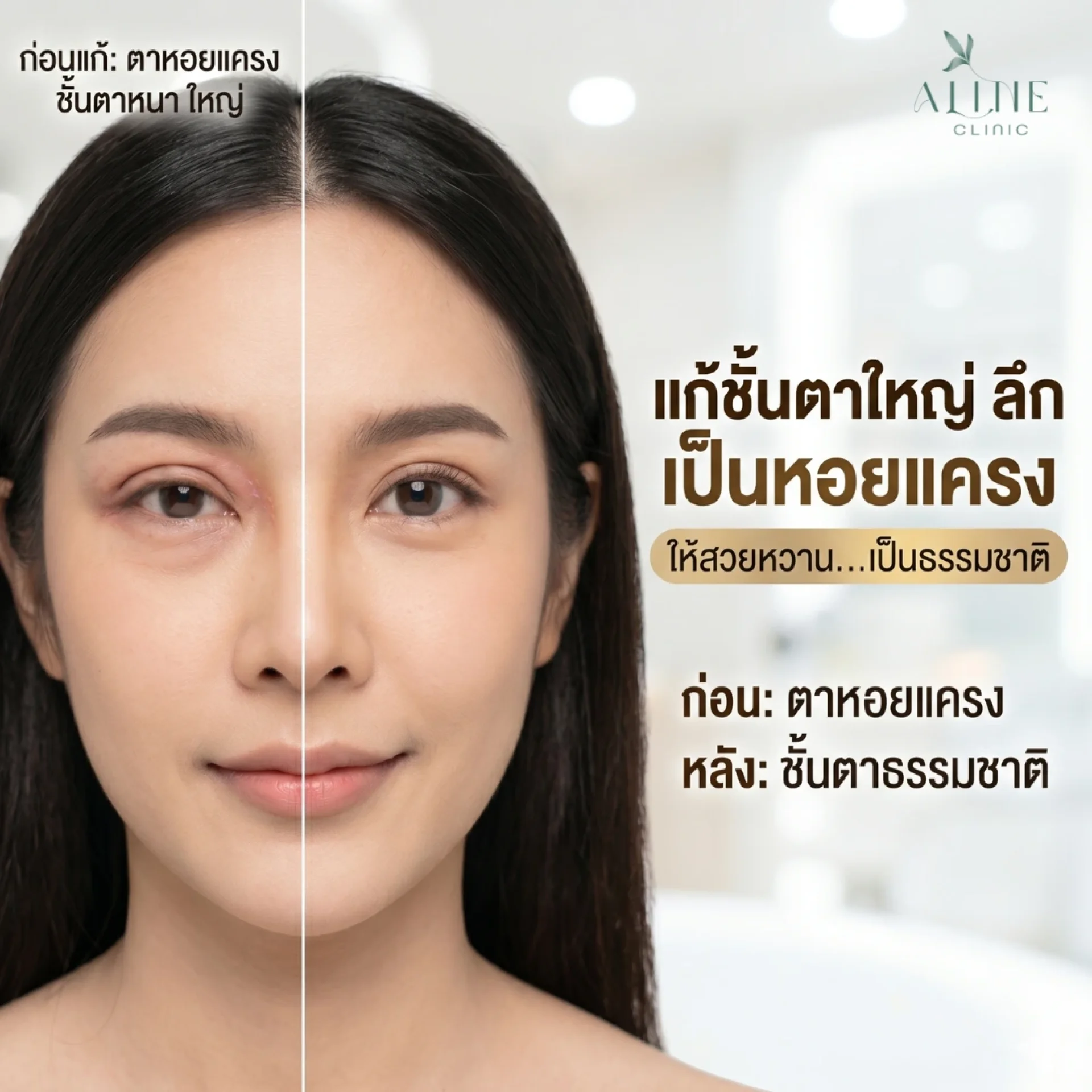 แก้ตาหอยแครง แก้ตาหอยแครง