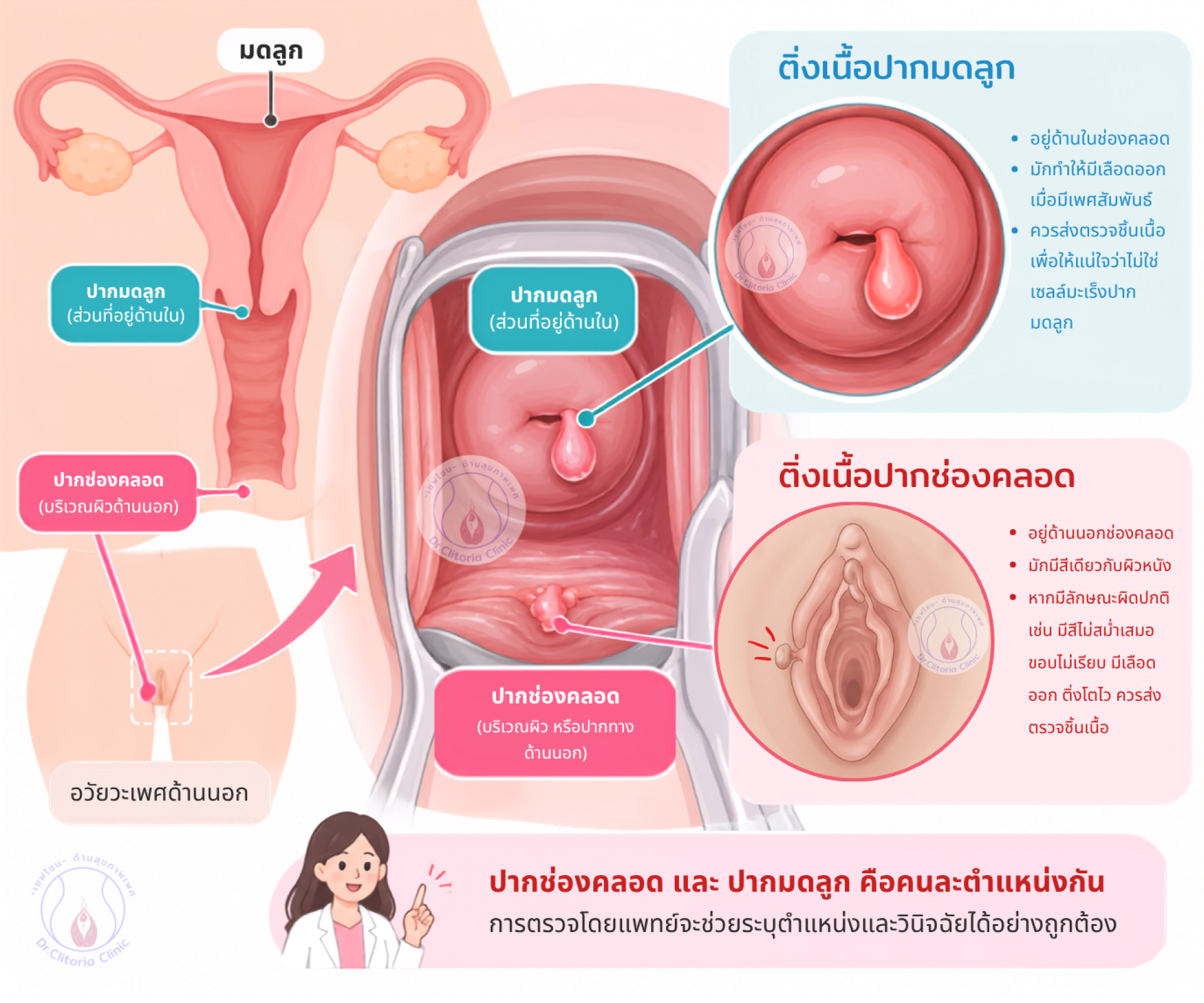 vulvar skin tag ติ่งเนื้อช่องคลอด ติ่งเนื้อปากช่องคลอด ติ่งเนื้อปากมดลูก ติ่งเนื้อที่แคม vulvar skin tag ติ่งเนื้อช่องคลอด ติ่งเนื้อปากช่องคลอด ติ่งเนื้อปากมดลูก ติ่งเนื้อที่แคม