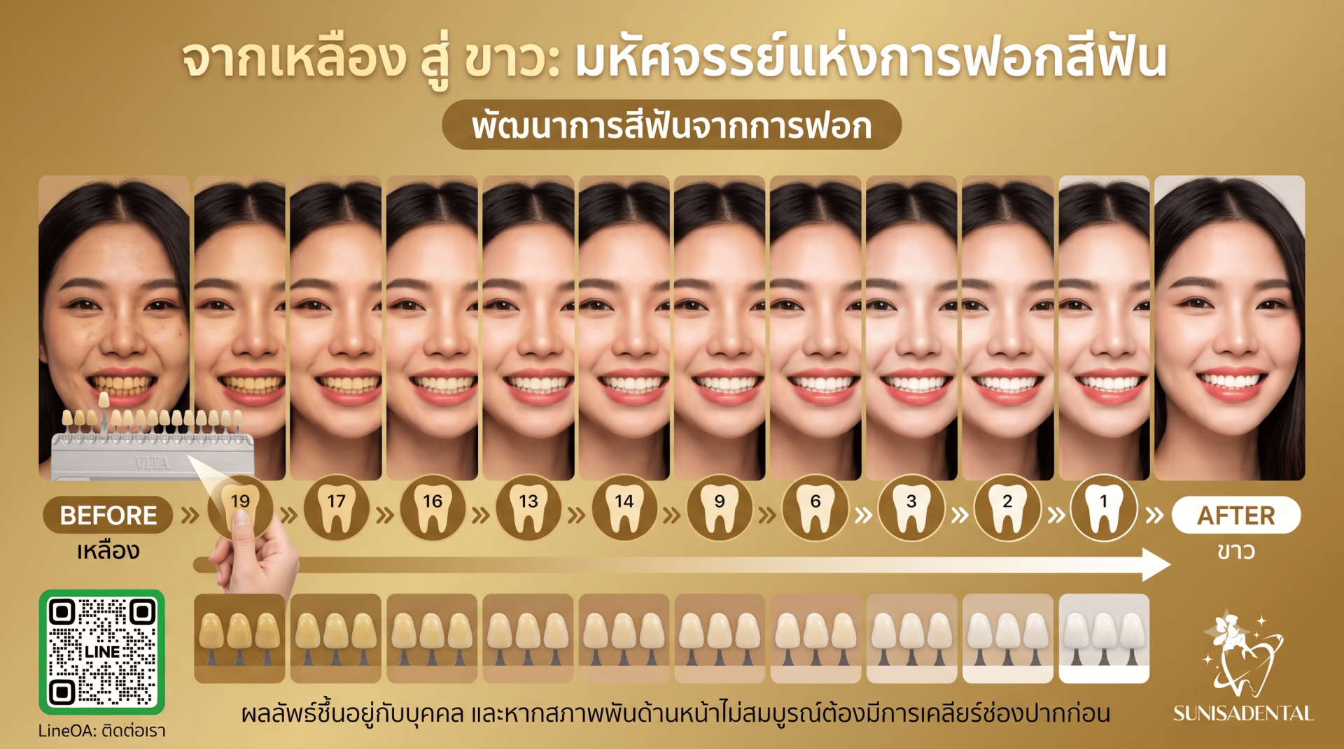 ทำฟันนครพนม ฟอกสีฟันนครพนม คลินิกทำฟันนครพนม ทำฟันนครพนม ฟอกสีฟันนครพนม ฟอกสีฟัน ทำฟันให้ขาว ทำฟันนครพนม ฟอกสีฟันนครพนม คลินิกทำฟันนครพนม ทำฟันนครพนม ฟอกสีฟันนครพนม ฟอกสีฟัน ทำฟันให้ขาว